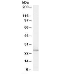 Western blot testing of human breast cancer lysate with TPD52L1 antibody at 0.1ug/ml. Predicted molecular weight: ~23/16/15kDa (isoforms 1/3/4).