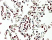 IHC staining of FFPE human lung with HOXB6 antibody at 5ug/ml. HIER: steamed with pH6 citrate buffer, AP-staining.