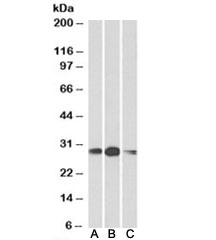 Western blot testing of human [A], mouse [B] and rat [C] kidney lysates with HOXA5 antibody at 1ug/ml. Predicted molecular weight: ~29kDa.~