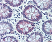 IHC testing of FFPE human small intestine tissue with NR1I2 antibody at 3.75ug/ml. Required HIER: steamed antigen retrieval with pH6 citrate buffer; AP-staining.