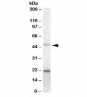 Western blot testing of K562 lysate with TXNDC4 antibody at 0.2ug/ml. Predicted molecular weight: ~47kDa. Both observed bands are blocked by addition of immunizing peptide.