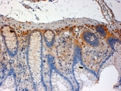 IHC staining of FFPE human colon with CSK antibody at 4ug/ml. HIER: steamed with pH6 citrate buffer, HRP-staining.