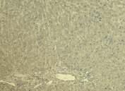Negative control: IHC staining of FFPE rat liver tissue without KCNQ1 antibody. Required HIER: steamed antigen retrieval with pH6 citrate buffer.