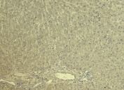 Negative control: IHC staining of FFPE rat liver tissue without KCNQ1 antibody. Required HIER: steamed antigen retrieval with pH6 citrate buffer.
