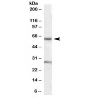 Western blot testing of human heart lysate with KCNQ1 antibody at 1ug/ml. Predicted molecular weight ~75/61 kDa (isoforms). Both observed bands are blocked by addition of the immunizing peptide.
