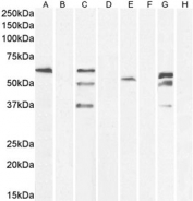 Western blot testing of human A) A431 cell lysate, B) A431 cell lysate + immunizing peptide, C) A431 cell lysate, D) A431 cell lysate + immunizing peptide, E) HEK293 cell lysate, F) HEK293 cell lysate + immunizing peptide, G) HEL cell lysate, H) HEL cell lysate + immunizing peptide with TOM1L1 antibody at 0.3ug/ml. Predicted molecular weight: ~53kDa.