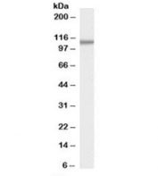 Western blot testing of human pancreas lysate with SMEK1 antibody at 0.3ug/ml. Predicted molecular weight: ~94kDa, observed here at ~110kDa.