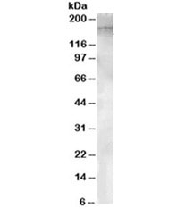 Western blot testing of human testis lysate with APA antibody at 1ug/ml. Predicted molecular weight ~109/160kDa (unmodified/glycosylated).~