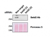 Western blot testing of mouse fibroblast lysates transiently expressing unrelated and two different siRNA with SETD2 antibody at 0.5ug/ml