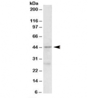Western blot testing of MCF7 lysate with PRMT6 antibody at 0.5ug/ml. Predicted molecular weight: ~42kDa.