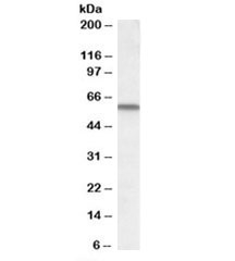 Western blot testing of human lung lysate with VCBP antibody at 1ug/ml. Predicted molecular weight: ~53kDa.
