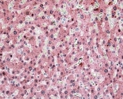 IHC testing of FFPE human liver with ITIH4 antibody at 4ug/ml. HIER: steamed with pH6 citrate buffer, AP-staining.