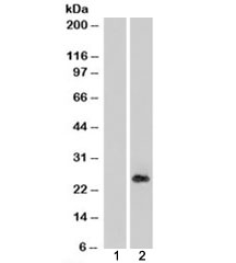 Western blot of HEK293 lysate overexpressing CSRP2 probed with CSRP2 antibody (mock transfection in lane 1). Predicted/observed molecular weight: ~21/26kDa.
