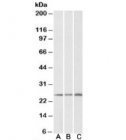 Western blot testing of human [A], mouse [B] and rat [C] kidney lysates with CSRP2 antibody at 0.2ug/ml. Predicted/observed molecular weight: ~21/26kDa.