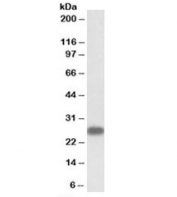Western blot testing of human heart lysate with TNNI3 antibody at 1ug/ml. Predicted molecular weight: ~24kDa, can also observed at ~28kDa.