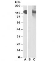 Western blot testing of HEK293 lysate overexpressing CDH11-MYC with CDH11 antibody [1ug/ml] in Lane A and with anti-MYC [1/1000] in lane C. Mock-transfected probed with anti-CDH11 [1ug/ml] in Lane B. Predicted molecular weight: ~88kDa but can be observed at 120-130kDa.