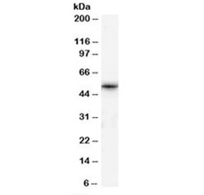 Western blot testing of human testis lysate with TPTE antibody at 1ug/ml. Predicted molecular weight: ~60kDa.~