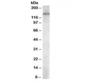 Western blot testing of human temporal cortex lysate with PREX1 antibody at 1ug/ml. Predicted molecular weight: ~186 kDa, observed here at ~150 kDa.