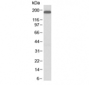 Western blot testing of human HepG2 cell lysate with LRP5 antibody at 1ug/ml. Predicted molecular weight ~179 kDa.