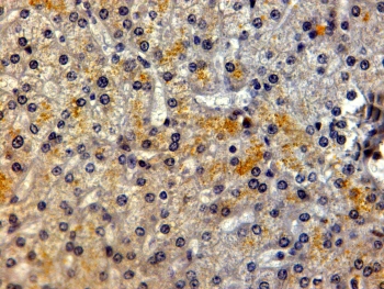 IHC testing of FFPE human liver with LRP5 antibody at 2ug/ml. HIER: steamed with pH6 citrate buffer, HRP-staining.