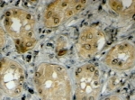 IHC testing of FFPE human kidney with LRP5 antibody at 4ug/ml. HIER: steamed with pH6 citrate buffer, HRP-staining.