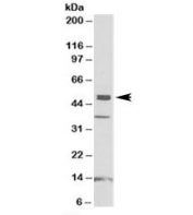 Western blot testing of human frontal cortex lysate with NPTX1 antibody at 1ug/ml. Predicted molecular weight: ~47kDa. The three observed bands are blocked by addition of immunizing peptide.