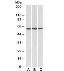 Western blot testing of mouse NIH3T3 [A], A549 [B], and HeLa [C] lysates with MMP14 antibody at 1ug/ml. Predicted molecular weight: ~66/54kDa.