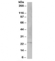 Western blot testing of human testis lysate with VSP28 antibody at 1ug/ml. Predicted molecular weight: ~25kDa.