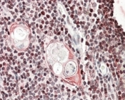 IHC staining of FFPE human thymus with SATB1 antibody at 4ug/ml. HIER: steamed with pH6 citrate buffer, AP-staining.