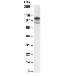 Western blot testing of MOLT4 lysate with SATB1 antibody at 0.3ug/ml. Predicted molecular weight ~86kDa, routinely observed at 100~110kDa.~