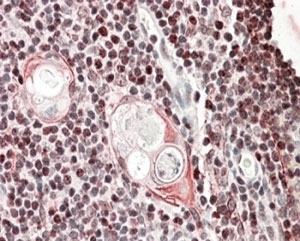 IHC staining of FFPE human thymus with SATB1 antibody at 4ug/ml. HIER: steamed with pH6 citrate
