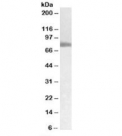 Western blot testing of human pancreas cancer lysate with TGM2 antibody at 0.05ug/ml. Predicted molecular weight: ~78kDa.