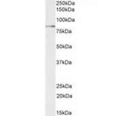 Western blot testing of human pancreas cancer lysate with TGM2 antibody at 0.05ug/ml. Predicted molecular weight: ~78kDa.