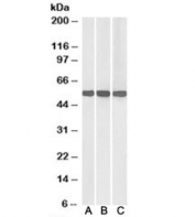 Western blot of human (A), mouse (B) and rat (C) liver lysate with GDH antibody at 0.01ug/ml. Predicted molecular weight ~61kDa.