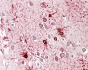 IHC staining of FFPE human cerebral cortex with GDH antibody at 4ug/ml. HIER: steamed with pH6 citrate buffer, AP-staining.