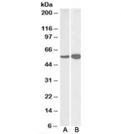 Western blot testing of human [A] and mouse [B] brain lysate with GDH antibody at 0.03ug/ml. Predicted molecular weight ~61kDa.