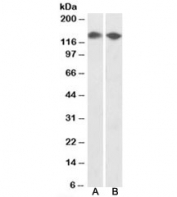 Western blot testing of HEK293 [A] and MCF7 [B] nuclear lysates with DBC1 antibody at 0.5ug/ml. Predicted molecular weight: ~103/140kDa (unmodified/acetylated).