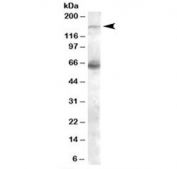 Western blot testing of human skeletal muscle lysate with NOS1 antibody at 0.1ug/ml. Predicted/observed molecular weight: ~161 kDa.