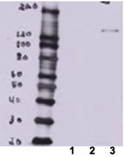 Western blot of MDCK lysate overexpressing mouse Btbd7 (lane 3) tested with BTBD7 antibody. Lane 1: mock transfection, lane 2: full construct chemically suppressed