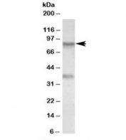 Western blot testing of A549 lysate with VAP-1 antibody at 0.1ug/ml. Predicted molecular weight ~85 kDa but may be observed at higher molecular weights due to glycosylation.