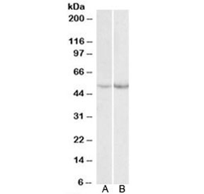 Western blot of mouse (A) and rat (B) liver lysate with PAH antibody at 0.1ug/ml. Predicted molecular weight: ~52kDa.