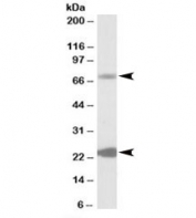 Western blot testing of human liver lysate with KCNN2 antibody at 0.3ug/ml. Predicted molecular weight: ~64/26kDa (isoforms 1/2).