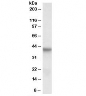Western blot testing of HepG2 lysate with PINX1 antibody at 0.3ug/ml. Predicted molecular weight: ~37kDa.