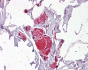 IHC testing of FFPE human colon tissue with VAV2 antibody at 2.5ug/ml. Required HIER: steamed antigen retrieval with pH6 citrate buffer; AP-staining.