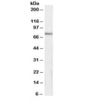 Western blot testing of human pancreas lysate with IP3KC antibody at 1ug/ml. Predicted/observed molecular weight: ~75kDa.