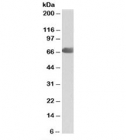 Western blot testing of human placenta lysate with C9 antibody at 2ug/ml. Predicted molecular weight: ~63/70kDa (unmodified/glycosylated).