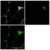 Immunofluorescence staining of mouse skeletal muscle with MYO5A antibody at 1ug/ml (first panel, and in green in third panel). Alpha-bungaratoxin staining in middle panel and in red in third panel.