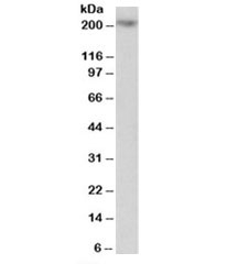 Western blot testing of Jurkat lysate with MYO5A antibody at 1ug/ml. Predicted molecular weight: ~215kDa.~