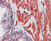 IHC staining of FFPE human prostate with VPS37C antibody at 4ug/ml. HIER: steamed with pH6 citrate buffer, AP-staining.