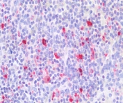 IHC staining of FFPE human spleen tissue with LFA-1 antibody at 5ug/ml. Required HIER: steamed antigen retrieval with pH6 citrate buffer; AP-staining.